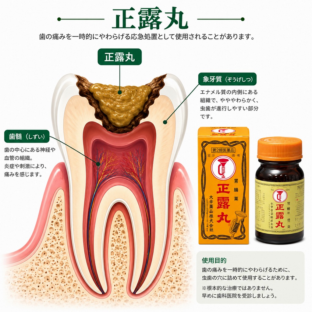 正露丸を虫歯の穴に詰める