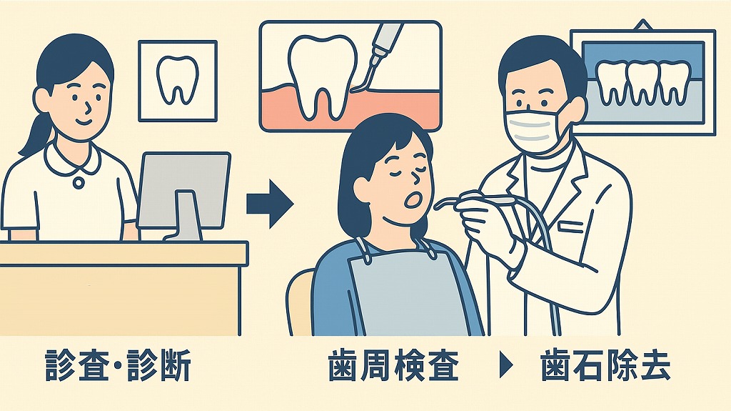保険診療での歯石取りのルール