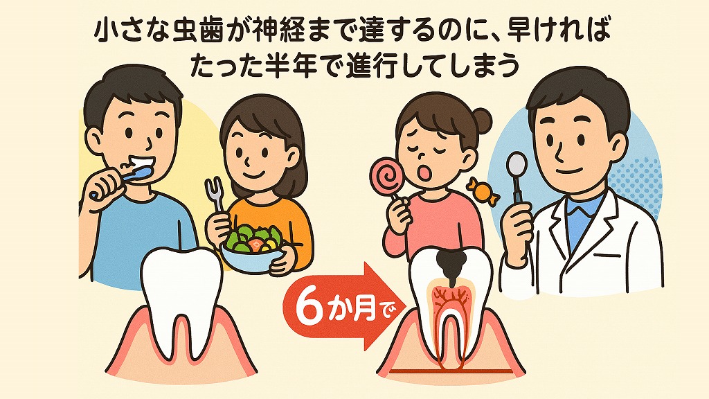 虫歯進行を左右する要因