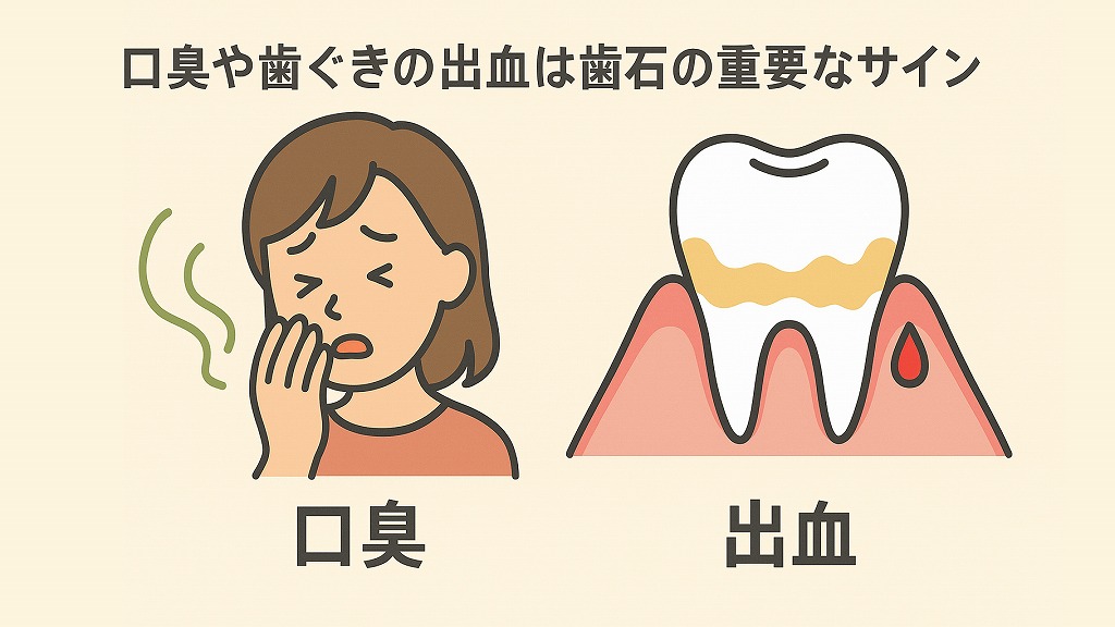 セルフチェックでわかる!歯石取りのタイミング