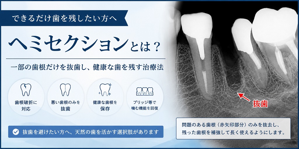 ヘミセクションとは