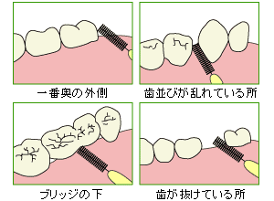 特に注意してケアすべき場所