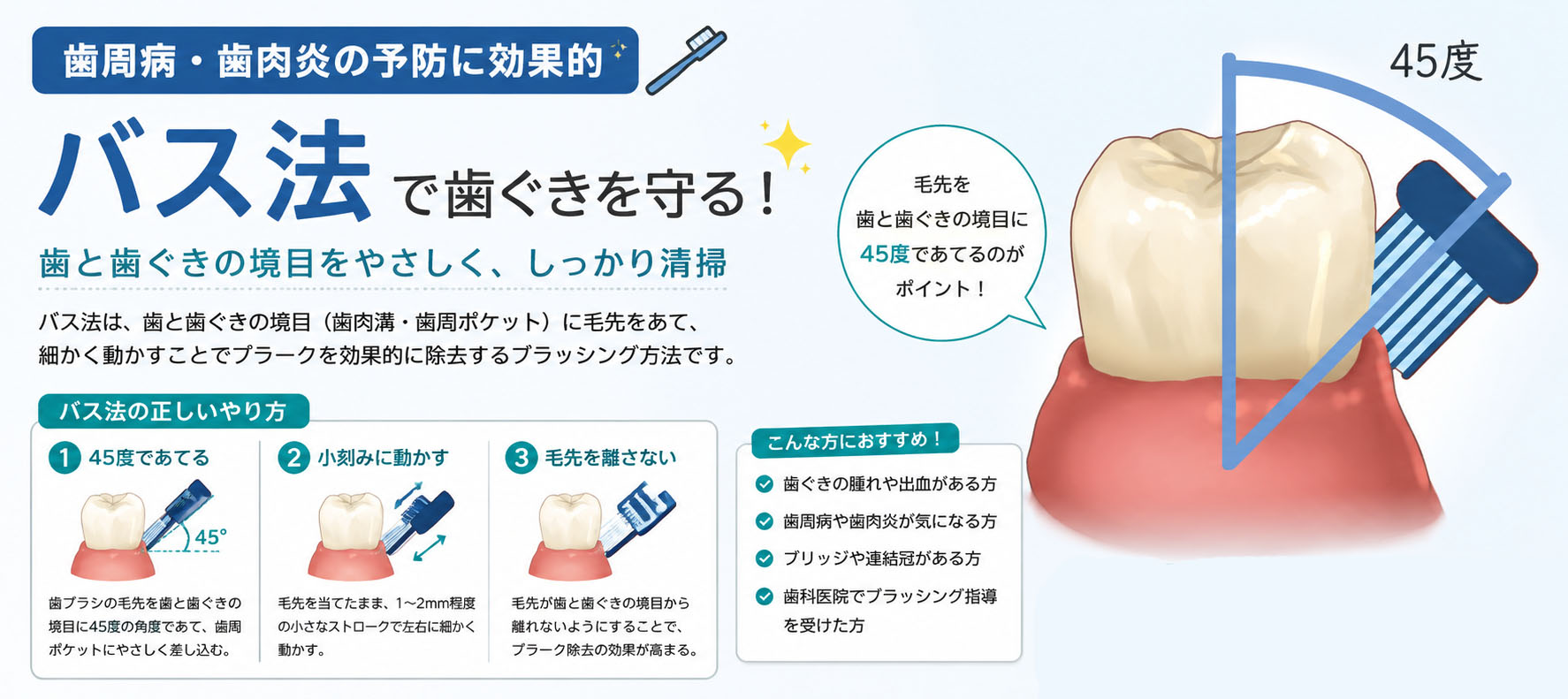 歯周病・歯肉炎の予防に効果的な「バス法」