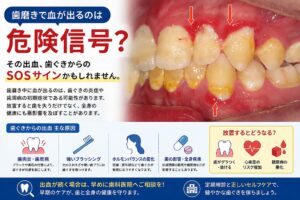 歯磨きで血が出るのは危険信号？