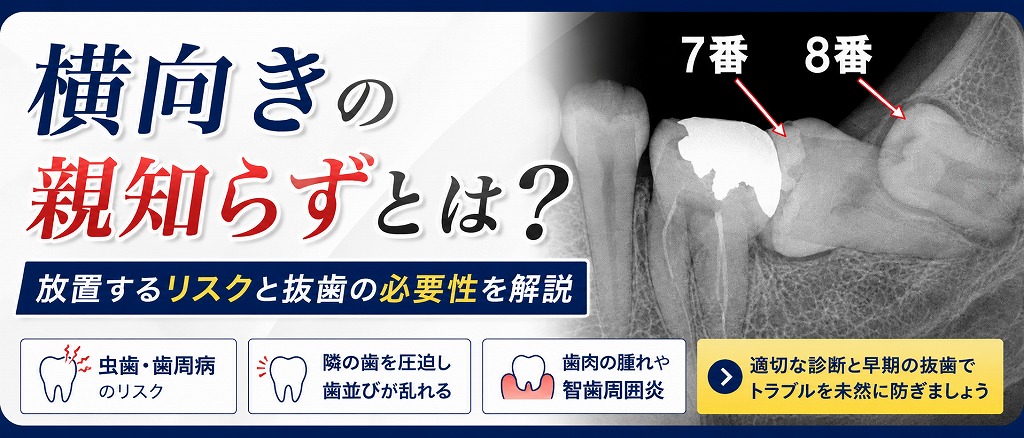 横向きの親知らずとは