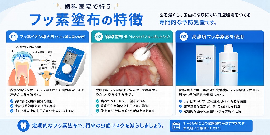 歯科医院で行うフッ素塗布の特徴