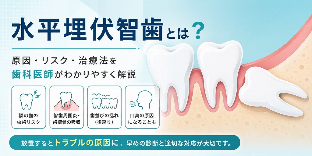 水平埋伏智歯とは