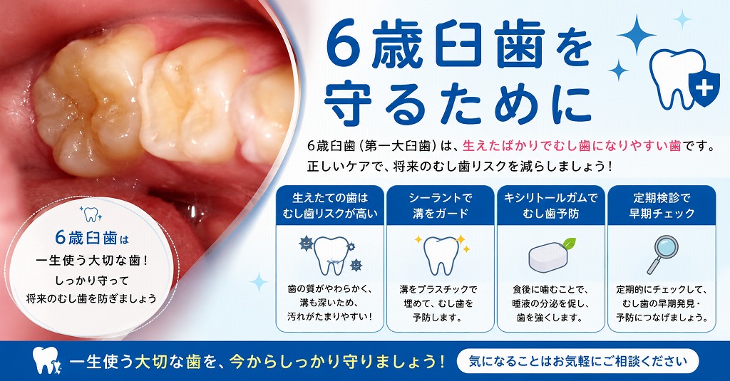 6歳臼歯を守るために