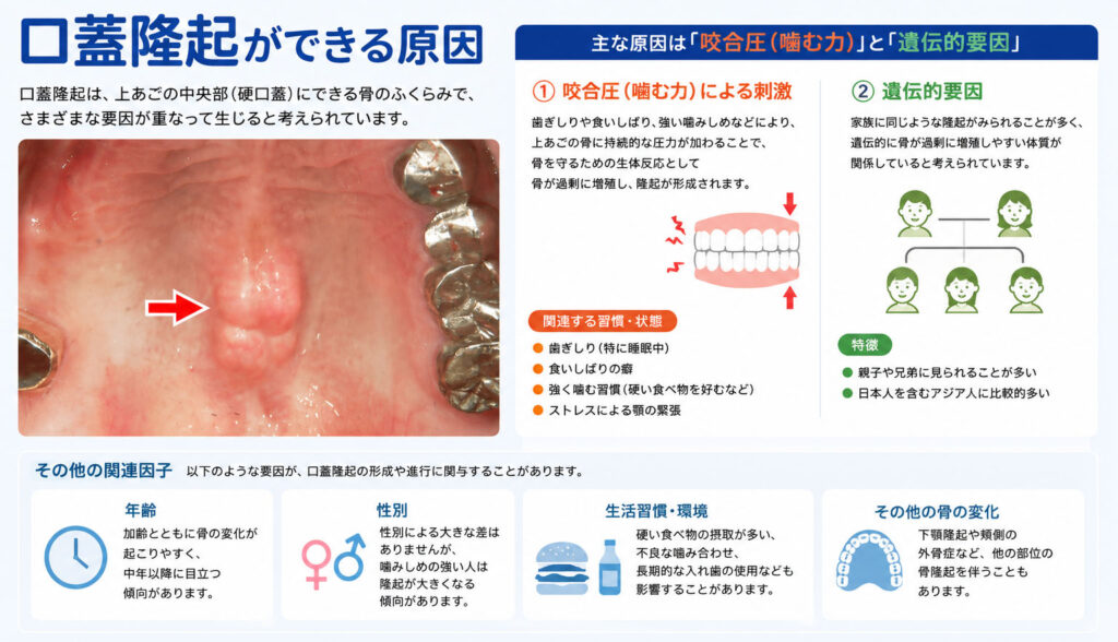 口蓋隆起ができる原因