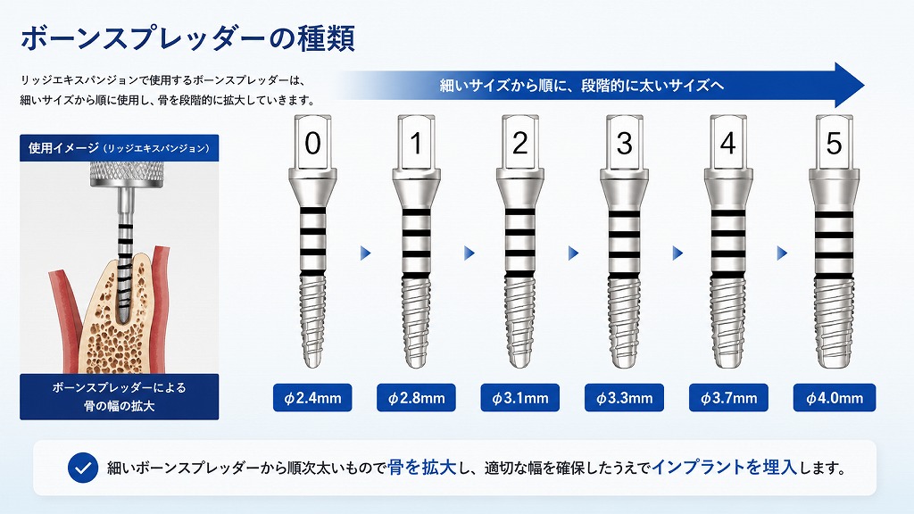 ボーンスプレッダーの種類