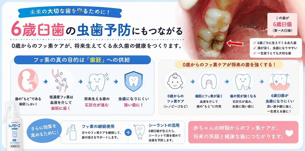 6歳臼歯の虫歯予防にもつながる