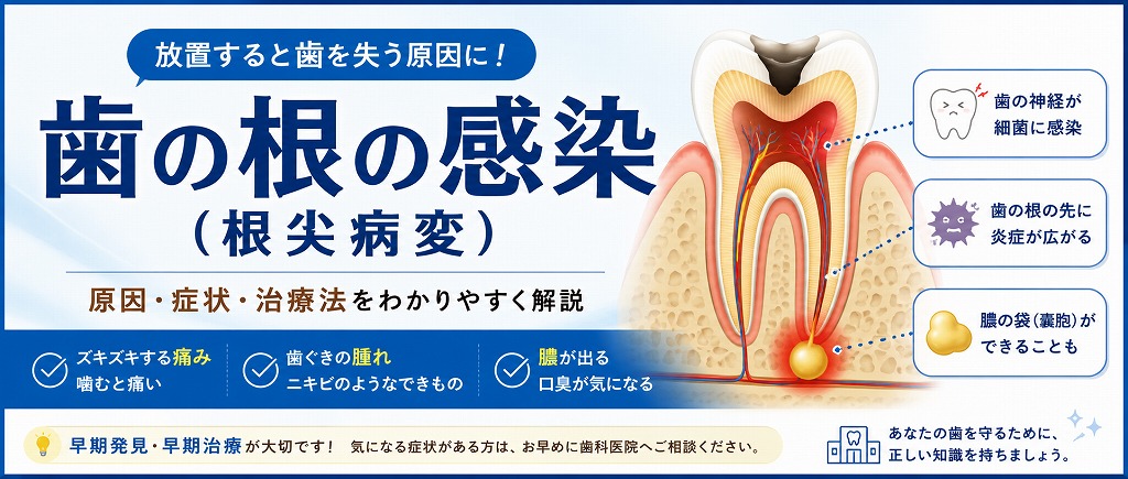 歯の根の感染（根尖病変）