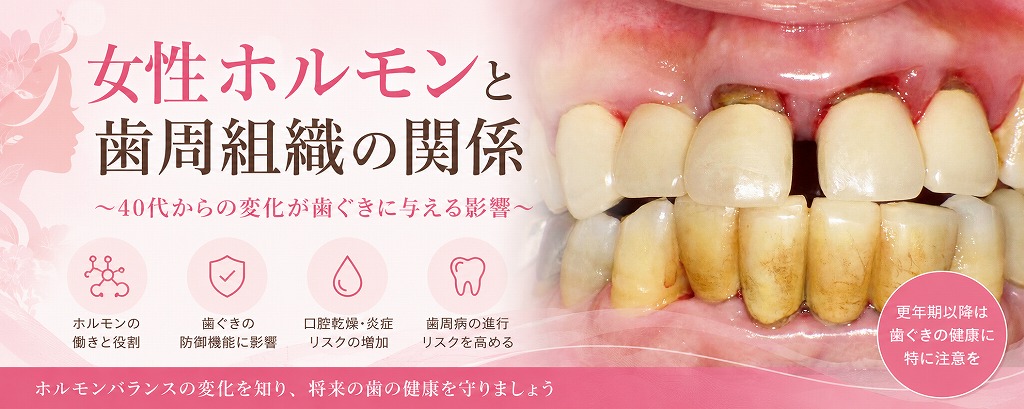 女性ホルモンと歯周組織の関係