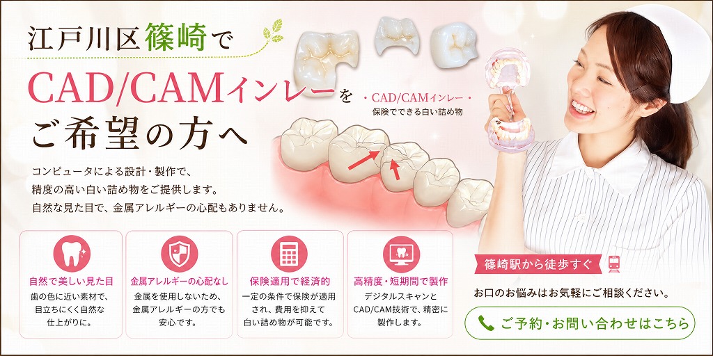 江戸川区篠崎でCAD/CAMインレーをご希望の方へ