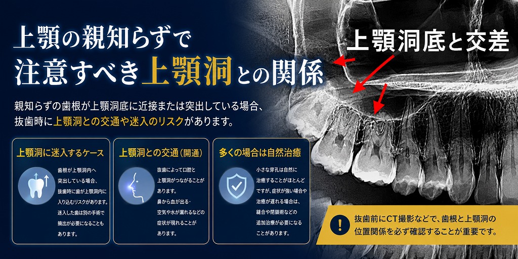 上顎の親知らずで注意すべき上顎洞との関係