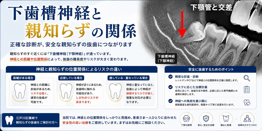下歯槽神経と親知らずの関係