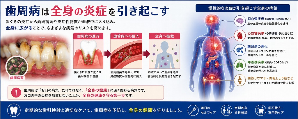 歯周病は全身の炎症を引き起こす