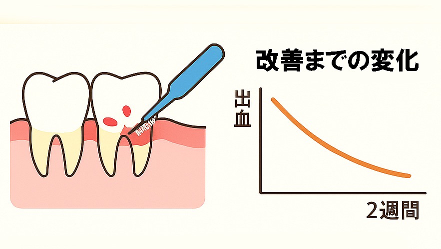 歯茎からの出血が止まらない場合