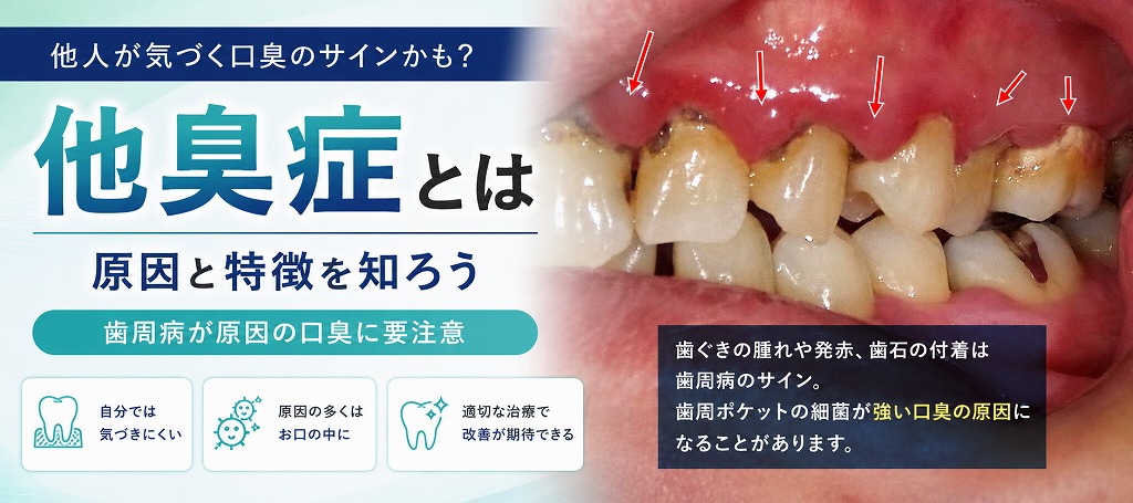 他臭症とは