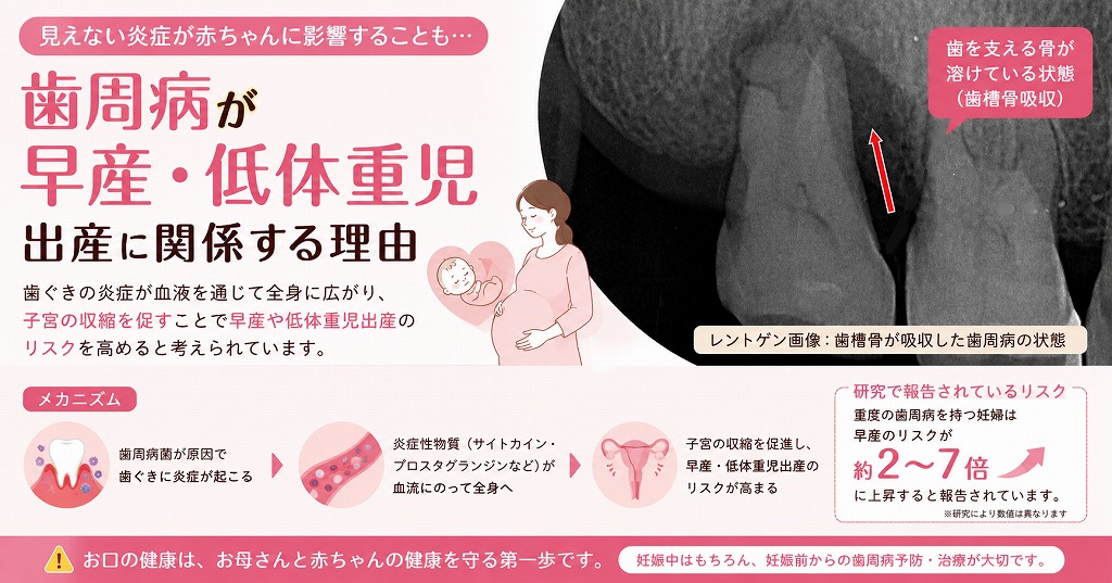 歯周病が早産・低体重児出産に関係する理由