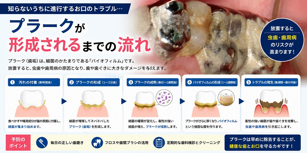 プラークが形成されるまでの流れ