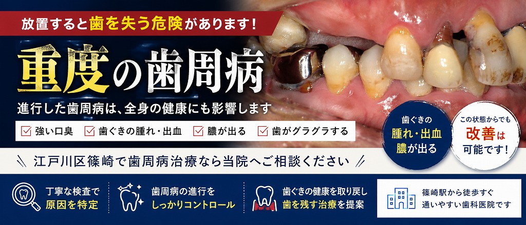 重度の歯周病