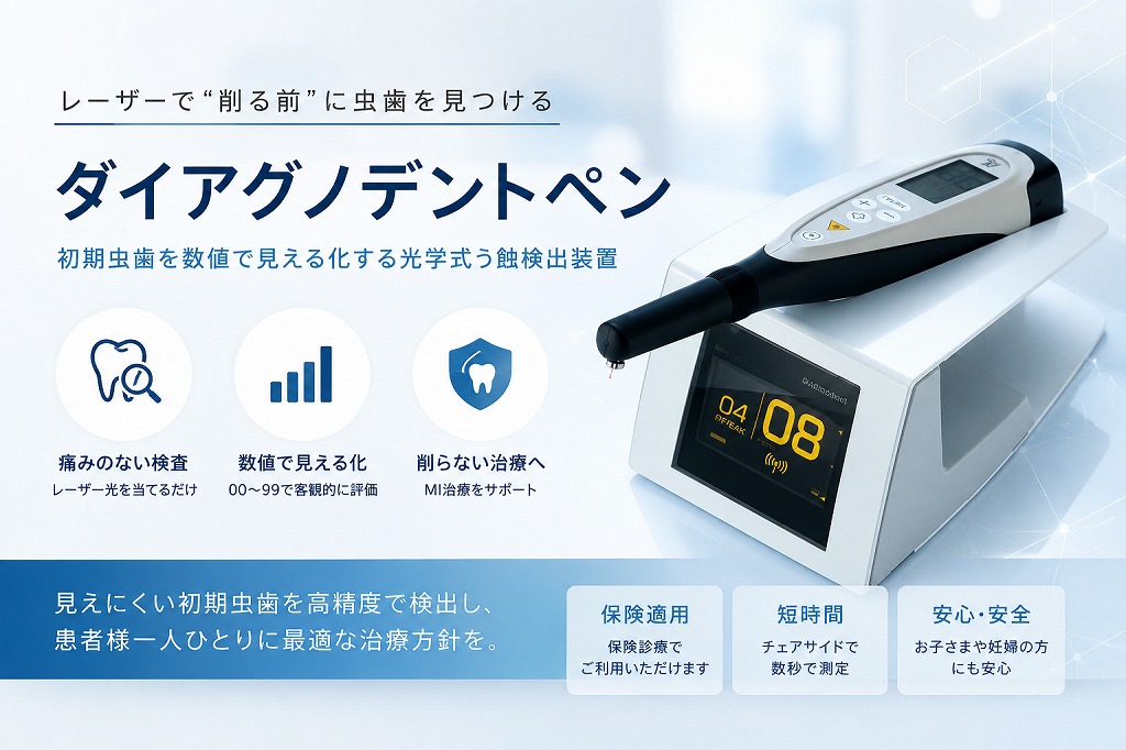 “削る前に見極める”レーザー虫歯診断装置 ダイアグノデントペン
