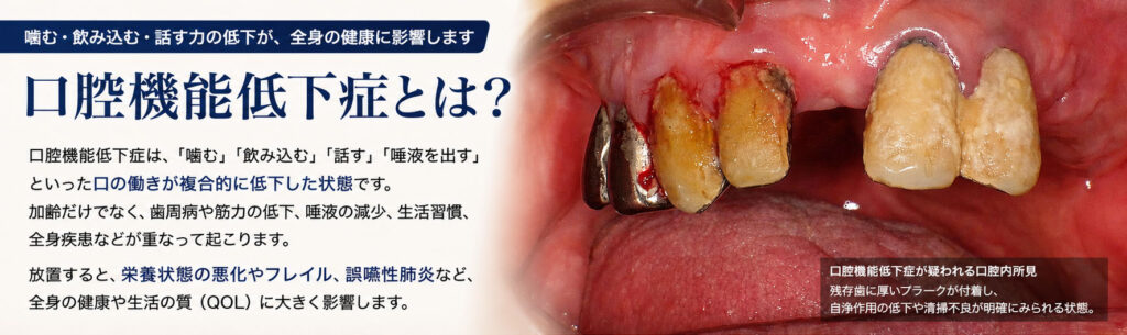 口腔機能低下症とは？