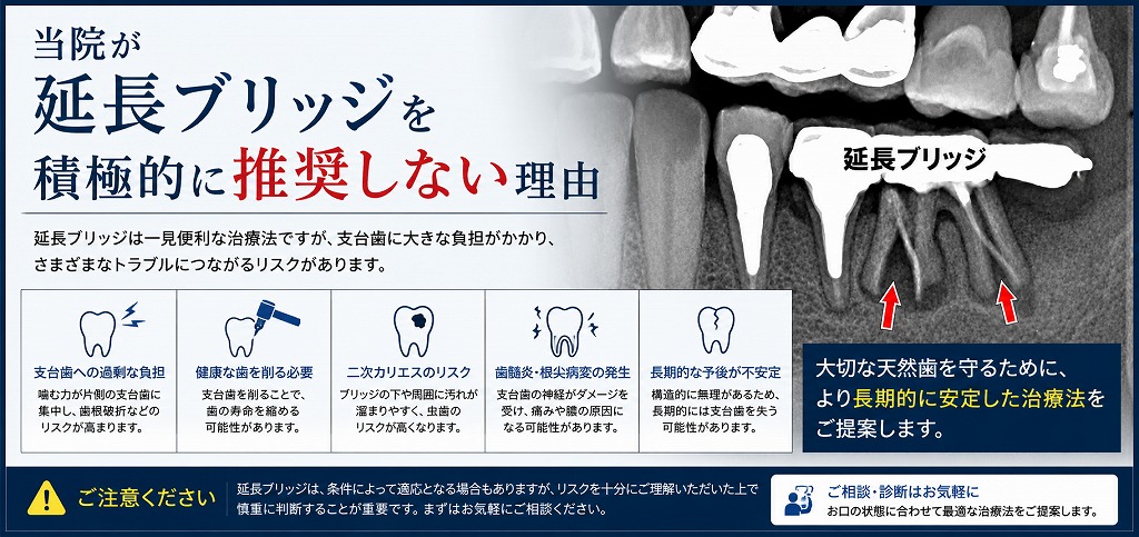 当院が延長ブリッジを積極的に推奨しない理由