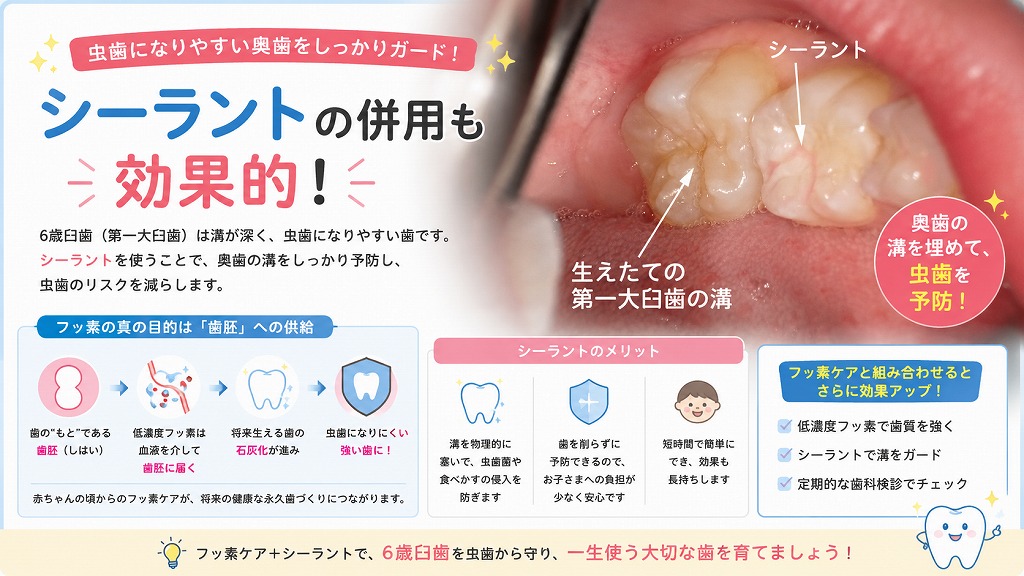 シーラントの併用も効果的
