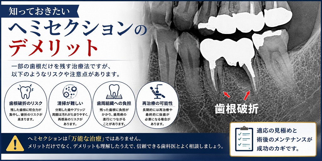 ヘミセクションのデメリット