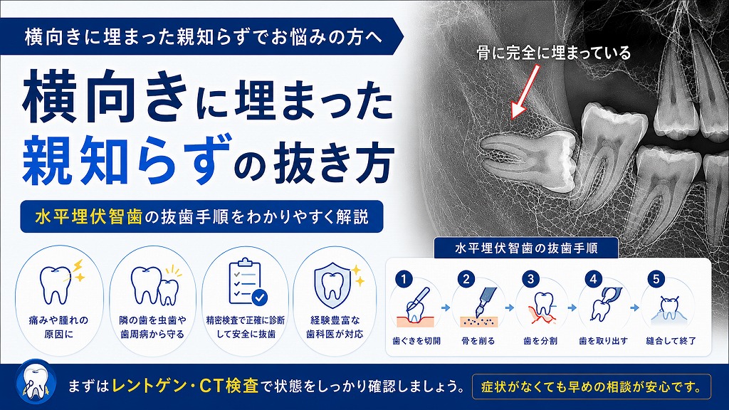 横向きに埋まった親知らずの抜き方