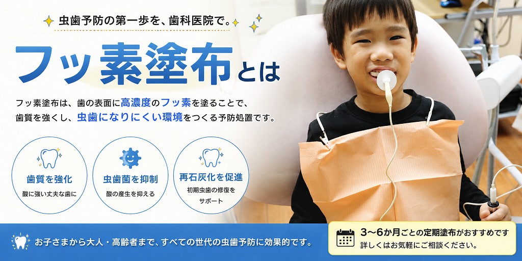 フッ素塗布とは