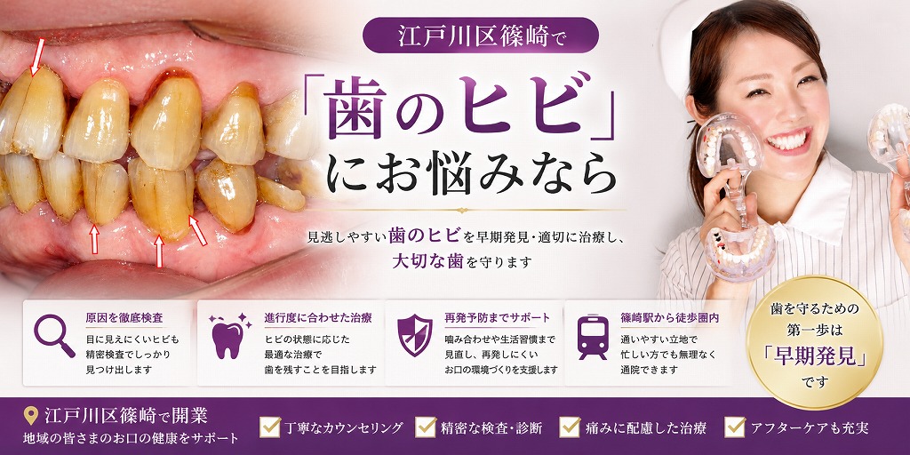 江戸川区篠崎で「歯のヒビ」にお悩みなら