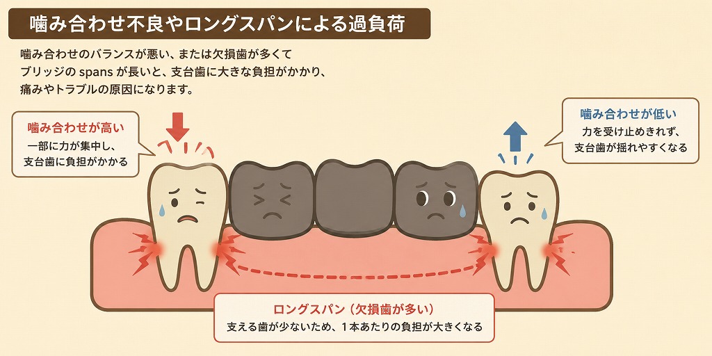 噛み合わせ不良やロングスパンによる過負荷