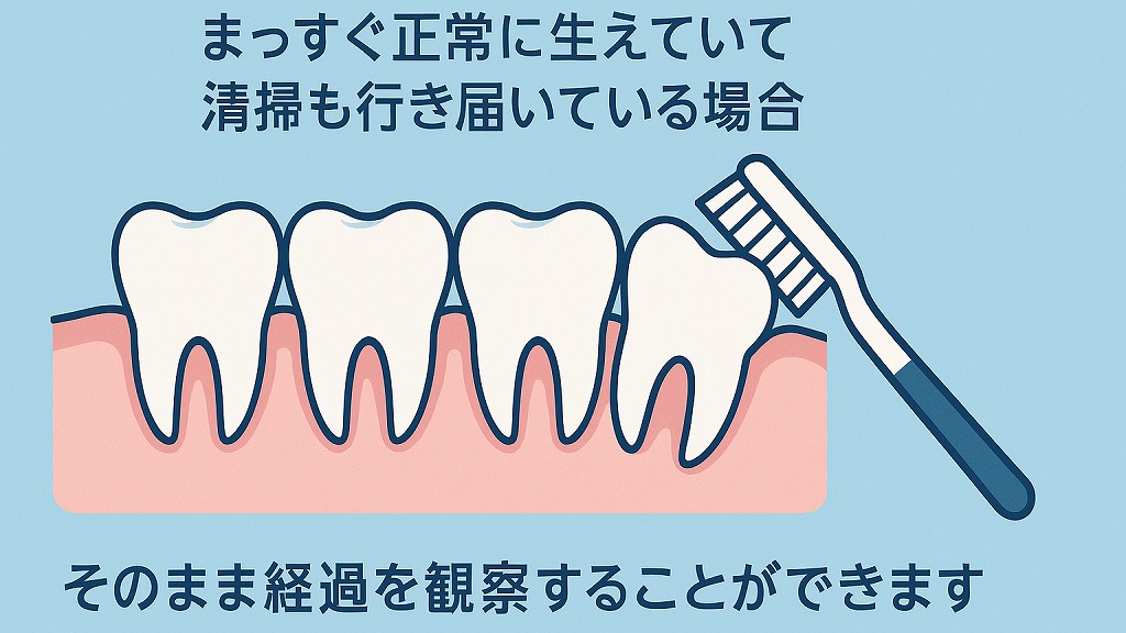 正常に生えていて、他の歯に悪影響がない場合