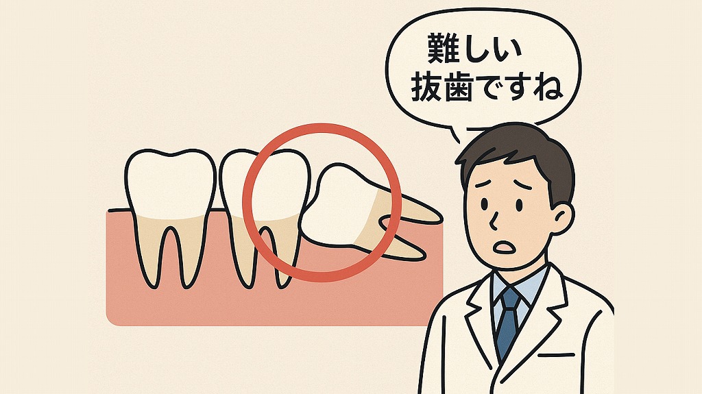 歯科医師が「難しい抜歯ですね」
