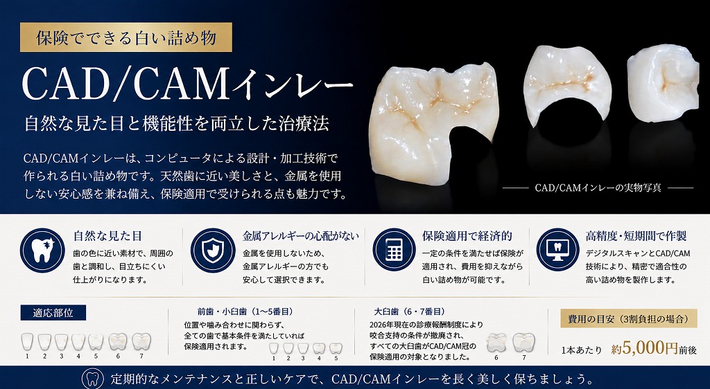 CAD/CAMインレーとは？