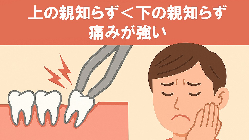 下の親知らずの方が痛みやすい
