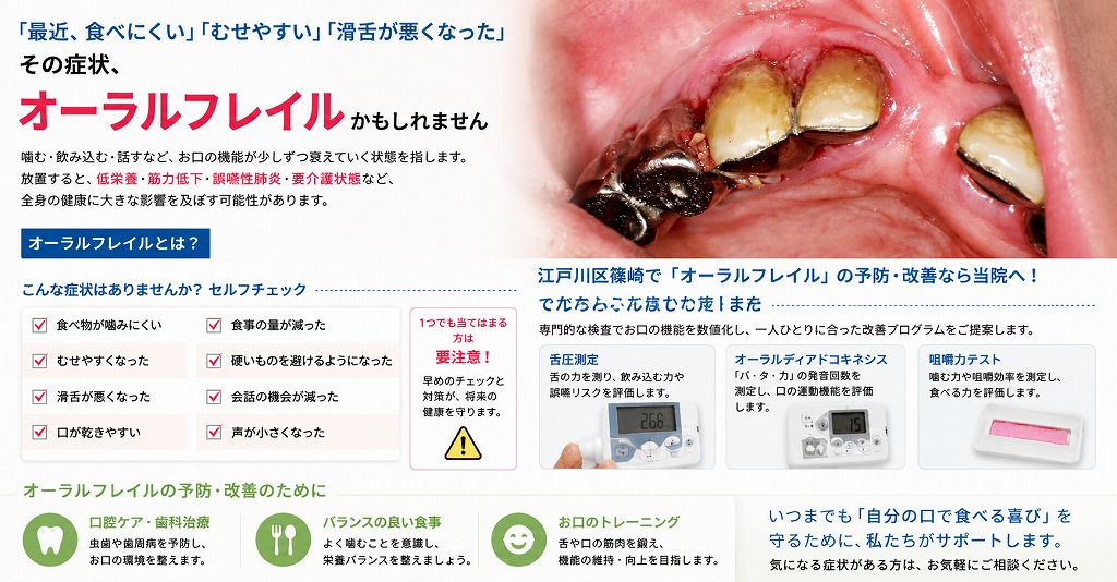 オーラルフレイルとは？口の衰えが全身の健康寿命を左右する