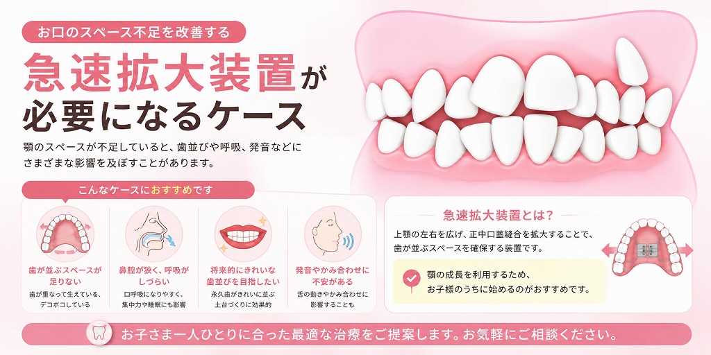急速拡大装置が必要になるケース