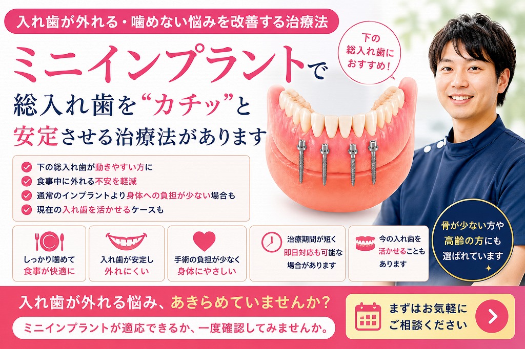 ミニインプラント｜入れ歯が外れる・噛めない悩みを改善する治療法