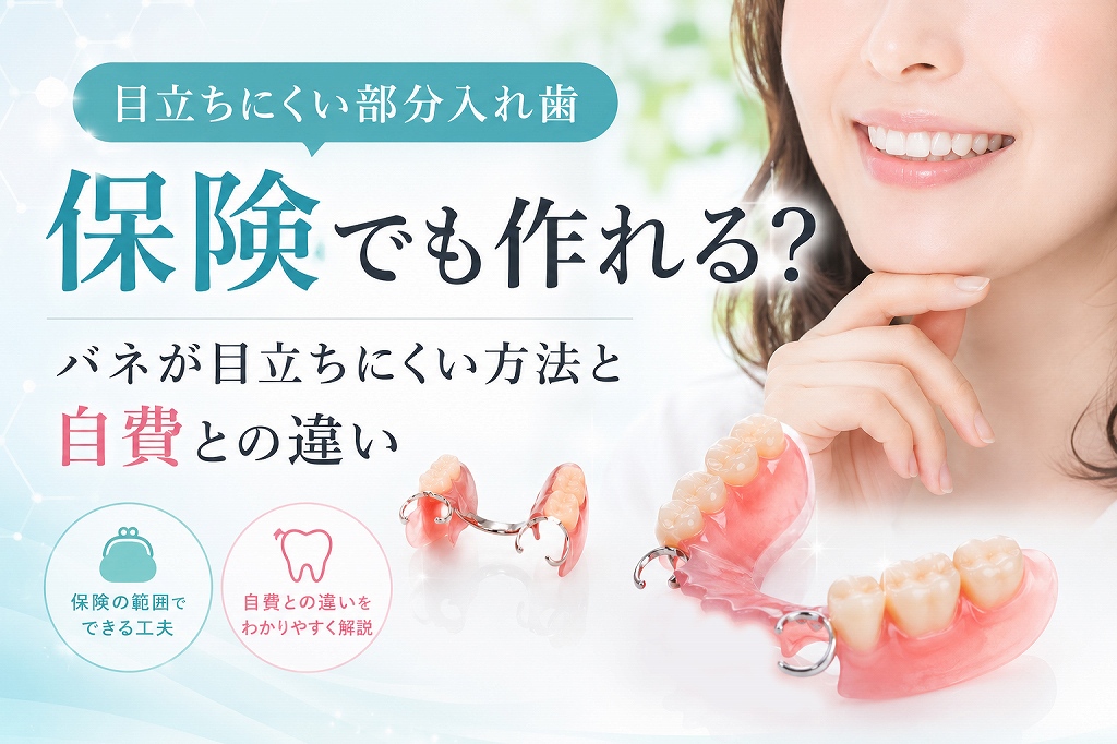 目立たない部分入れ歯は保険で作れる？バネを見えにくくする方法と自費