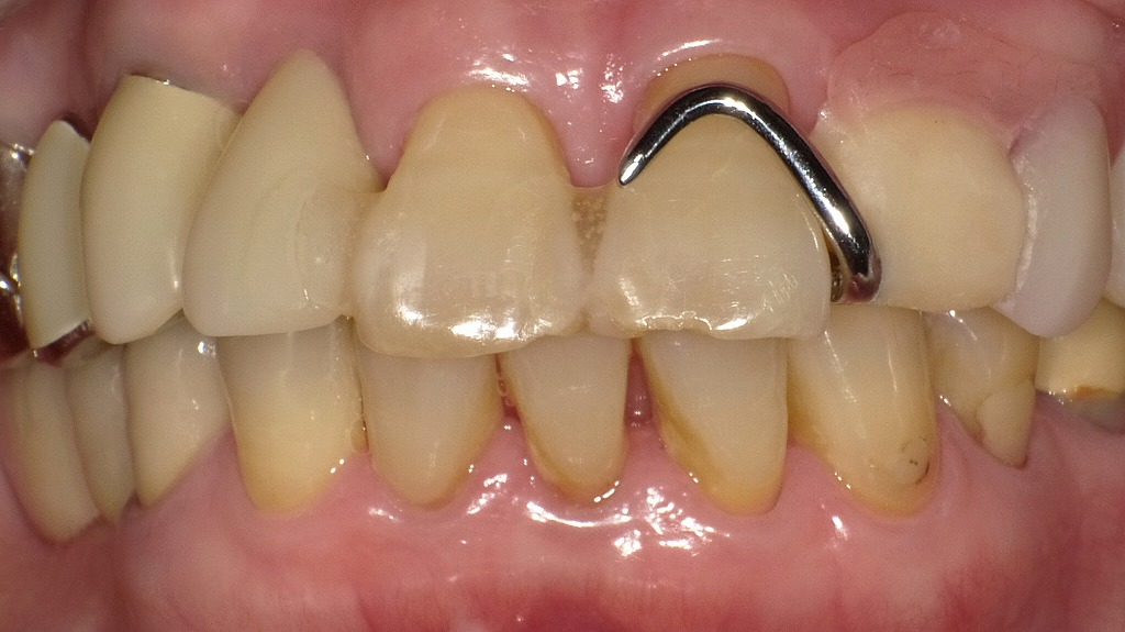 1枚目（正面から見た写真）