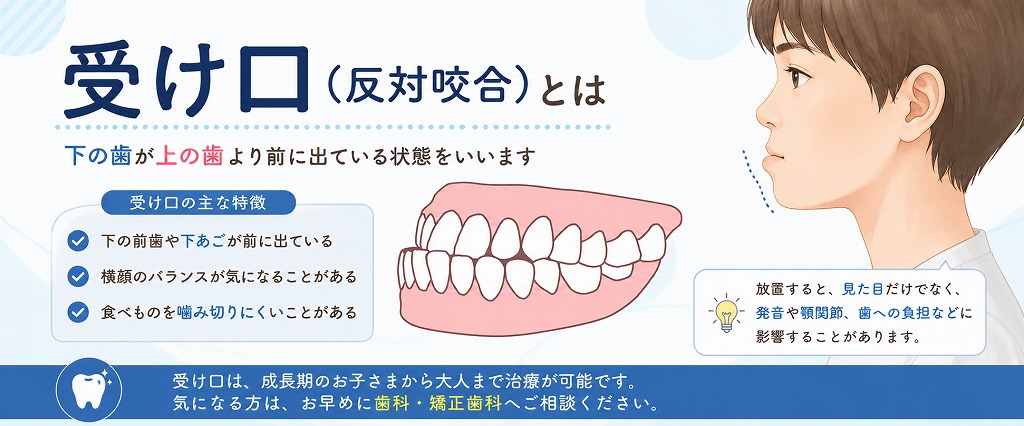 受け口（反対咬合）とは
