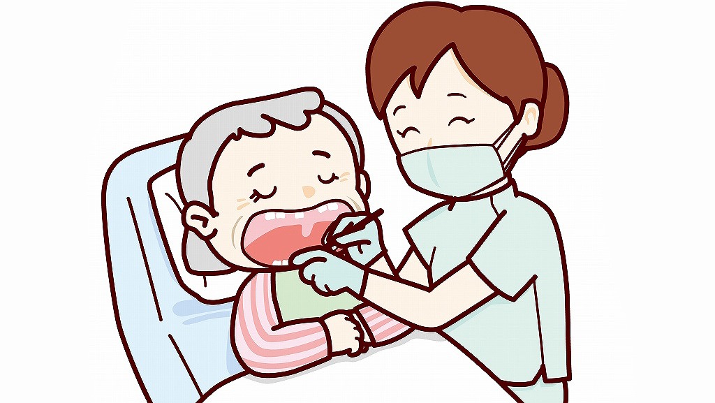 高齢者・寝たきり患者への根面う蝕対策
