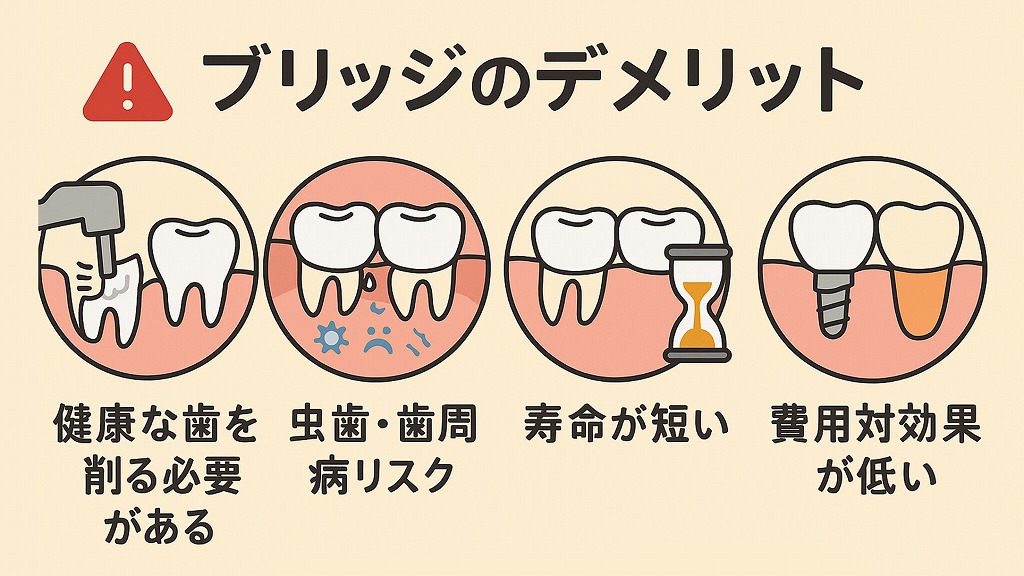 ブリッジ治療の主なデメリット