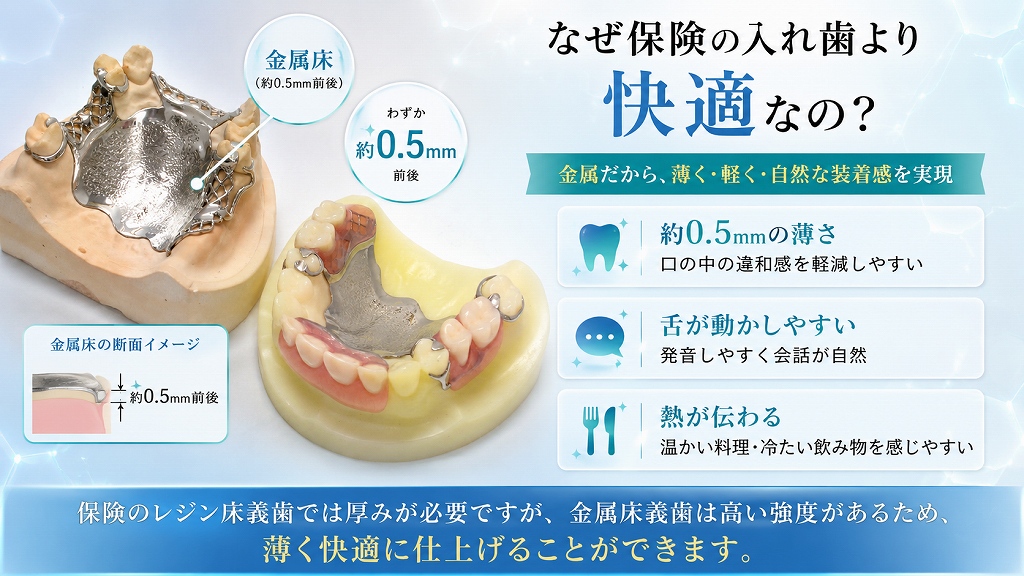 金属床義歯とは？保険の入れ歯との違い・メリット・費用を解説