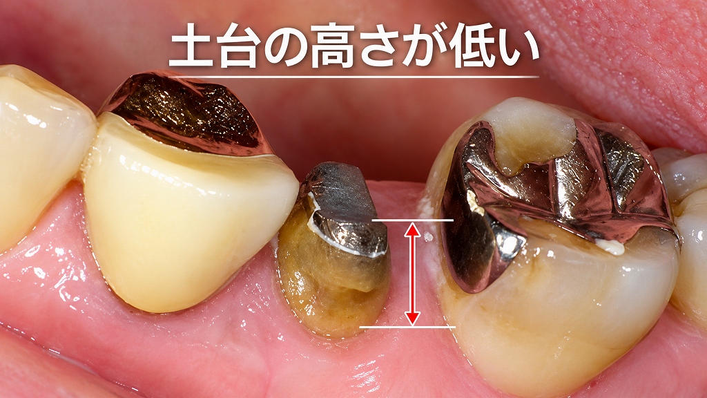 土台の高さが低い