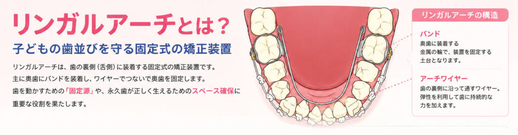 リンガルアーチとは？